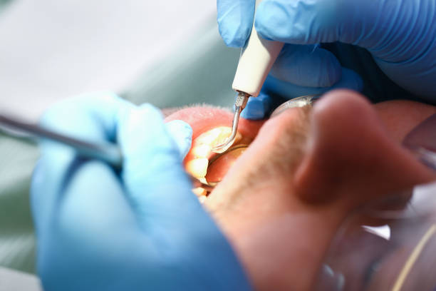 Best Emergency Tooth Extraction in Inkster, MI