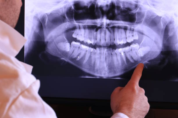 Best Emergency Wisdom Teeth Removal in Inkster, MI